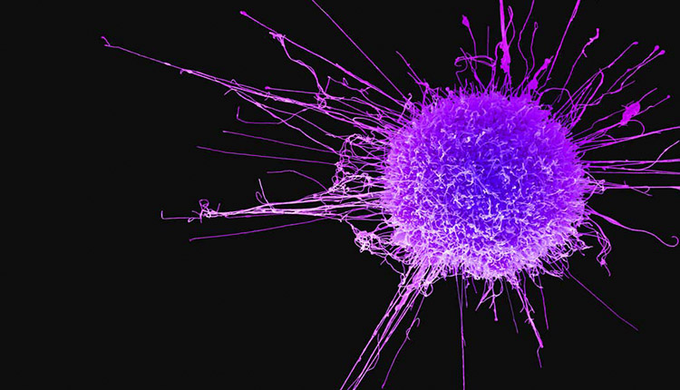 14 نشانه وجود سرطان که اغلب نادیده میگیریم!